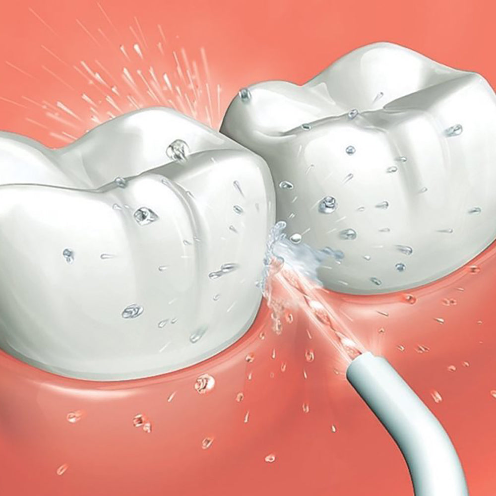 Irrigador Bucal Dental de Alta Presión, Perfecto para la Limpieza de Dientes, Incluye Boquilla Interdental y Boquilla Nasal, Tamaño Compacto, Ideal para Viajes, 21.5 x 4.5 cm